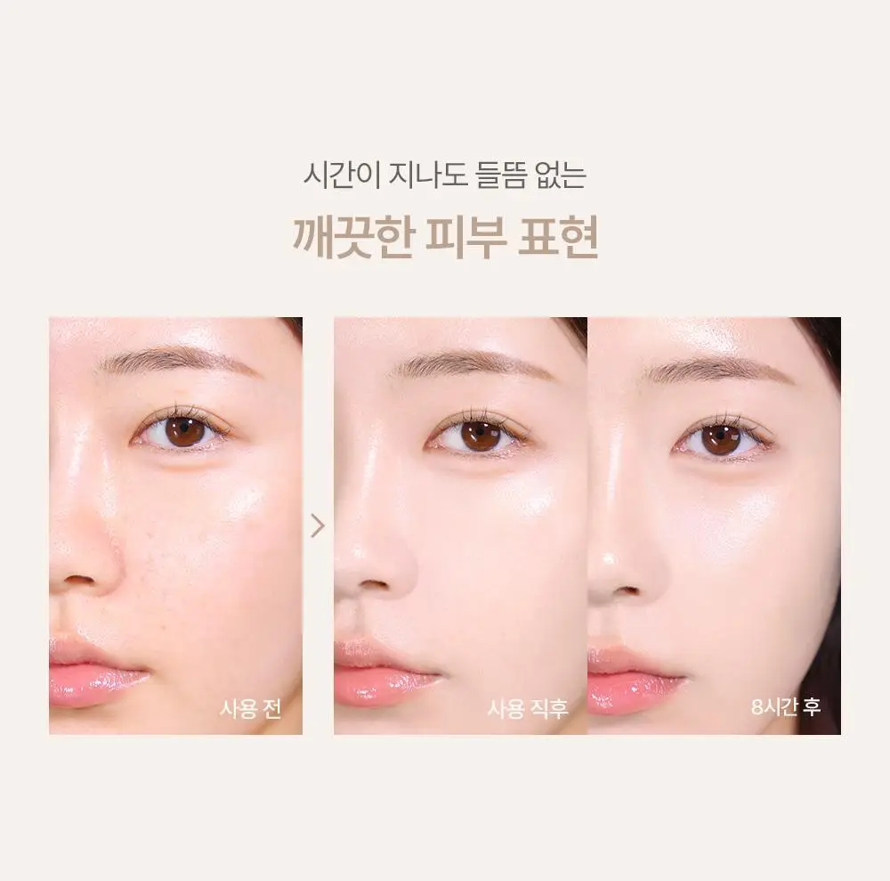 [에스트라 공동개발/5월 올영픽] 에스쁘아 더마커버 블레미쉬 밤 40g 2colors (+에스트라 클렌징폼) 상세페이지 36